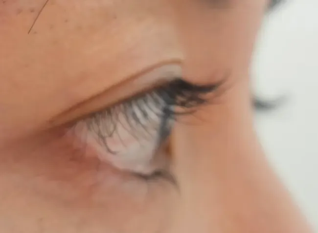 Lash curl condition before the treatment
