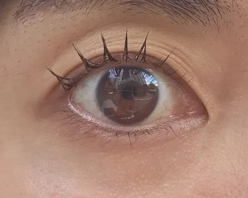 Drooping lashes before treatment