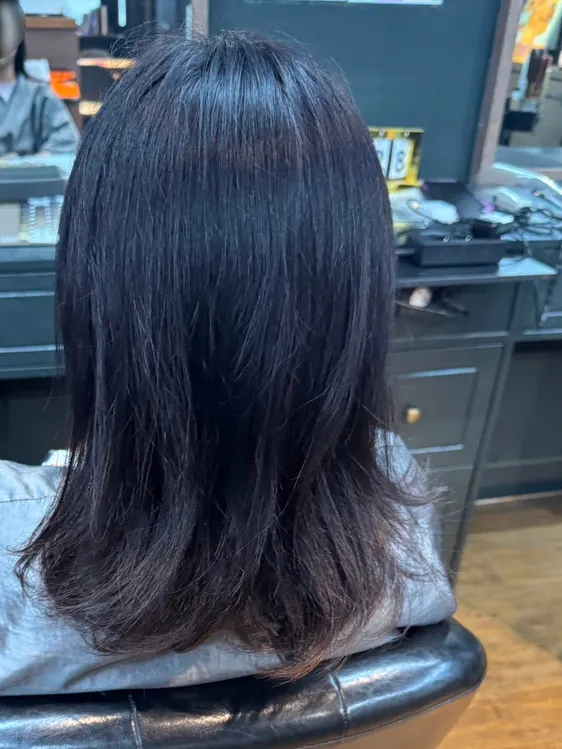 볼륨 없이 처진 시술 전 머리 측면