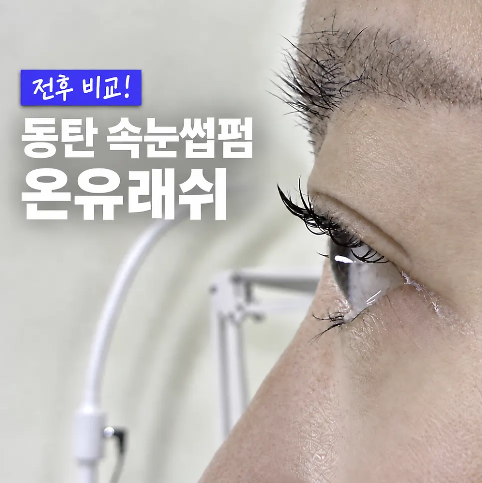 Main image for the Onyu Lash lift review in Dongtan