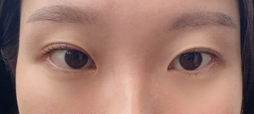 Before and after comparison of the lash lift