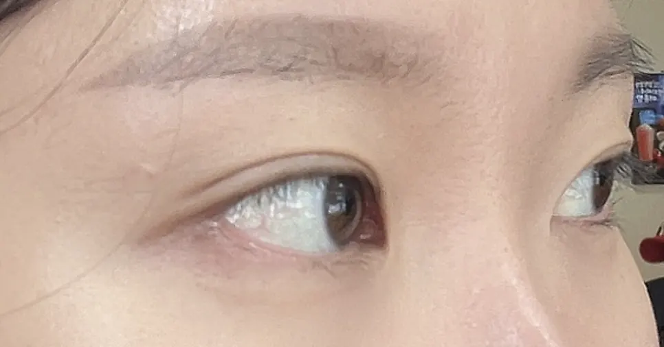 Front view of sunken lashes before the perm