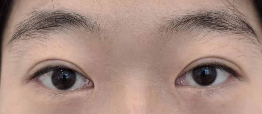 Before and after comparison of the lash lift and brow waxing