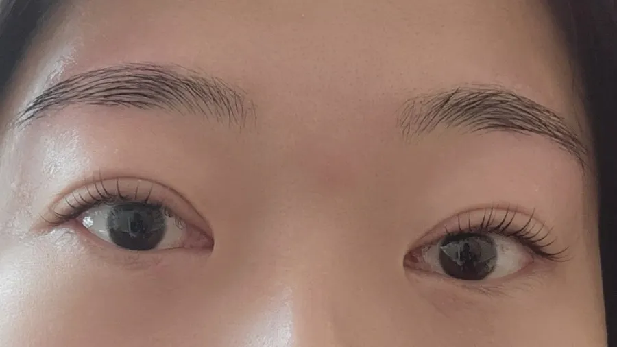 Final result on both eyebrows after the soothing pack