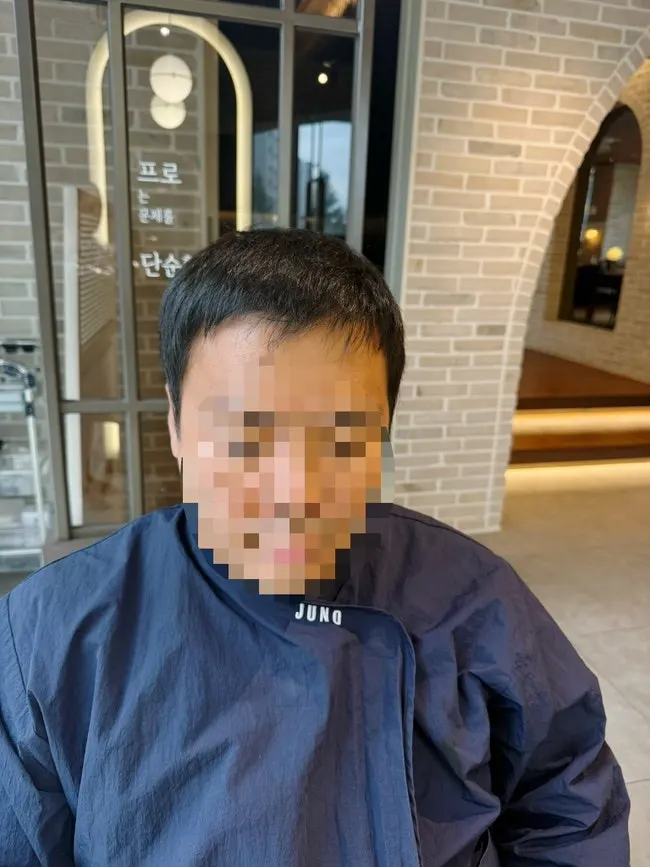 남성 커트 시술 전 길어진 머리