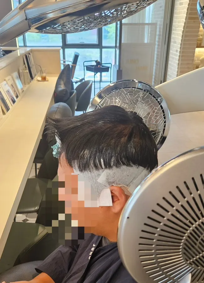 남성 다운펌 시술 진행 장면