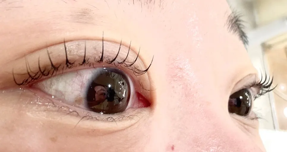 Eye area after a lower lash perm and black tinting