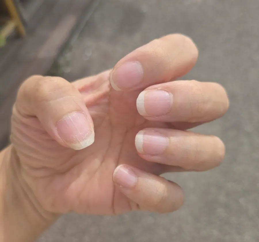 케어 전 길이가 제각각인 손톱