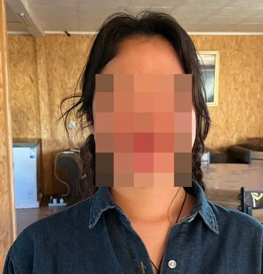 자라난 헤어라인의 반곱슬 모발 모습