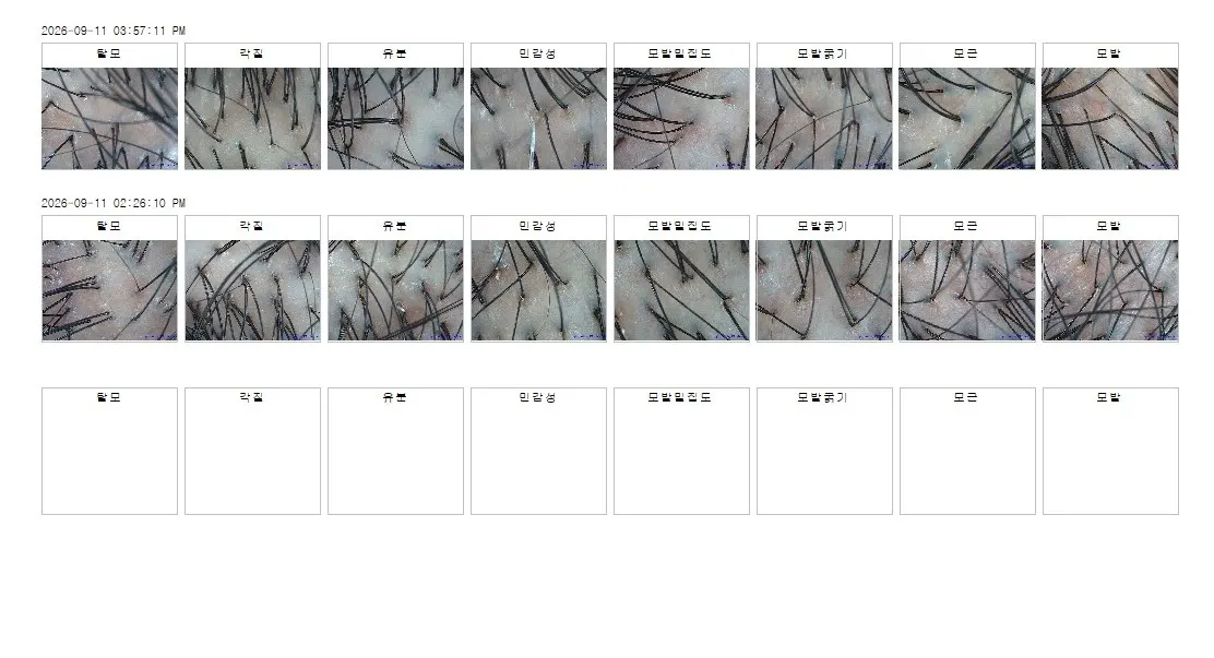 Before-and-after comparison of scalp condition
