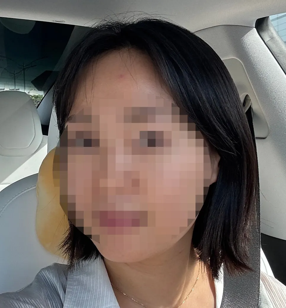 시술 전 부스스하게 뜬 단발 상태
