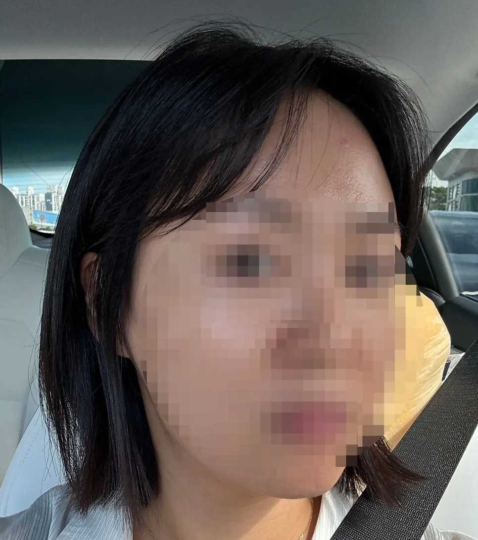 끝머리가 말려 올라간 시술 전 단발