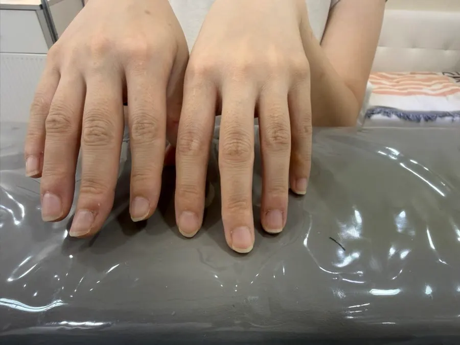 Untidy nails before the nail appointment