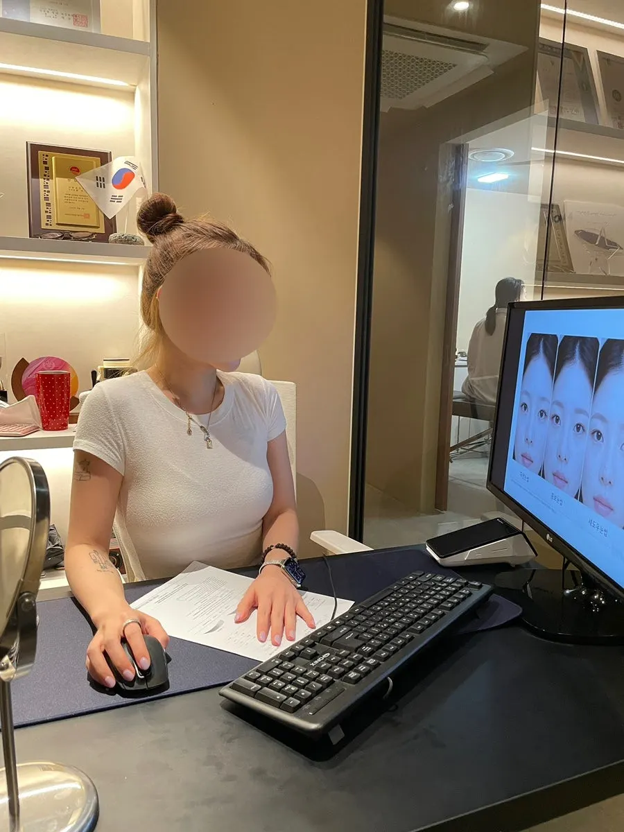 여성 정수리 SMP 두피문신 설명 이미지
