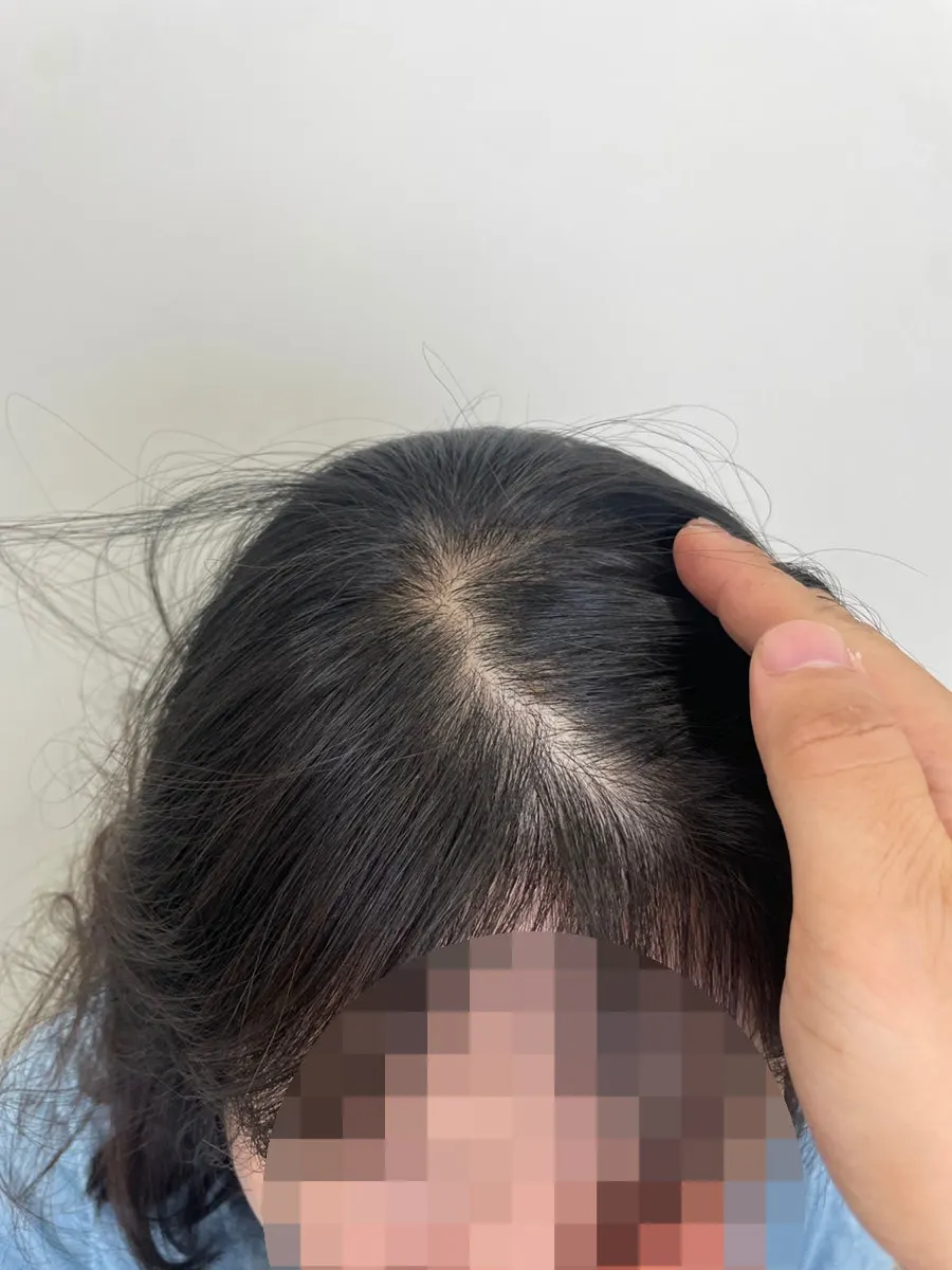 샴푸 시점 등 사후 관리 설명 이미지