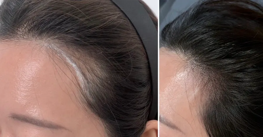 Comparison shot of the M-shaped area filled in with shading