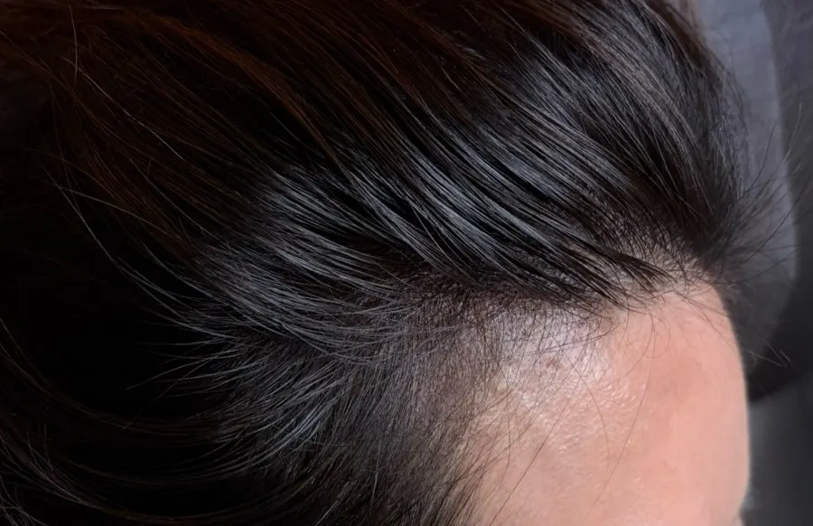 Hair slicked back to show the session 1 result