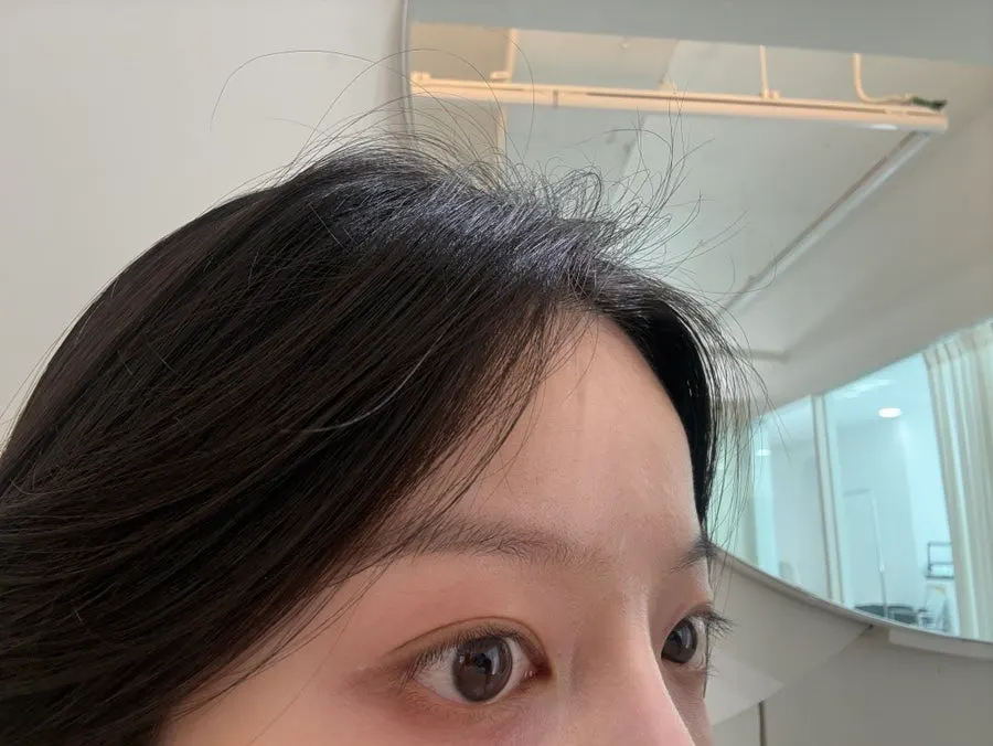 속눈썹펌 전 처진 쌩눈 비포