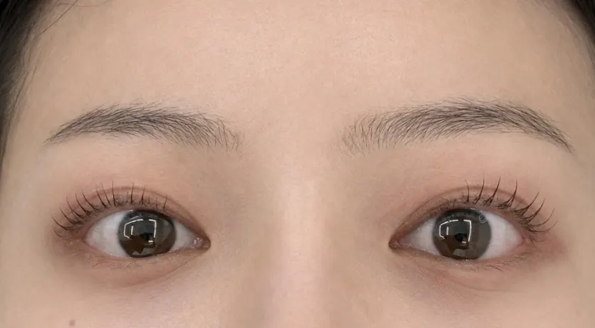 노글루 퓨어펌 직후 올라간 속눈썹