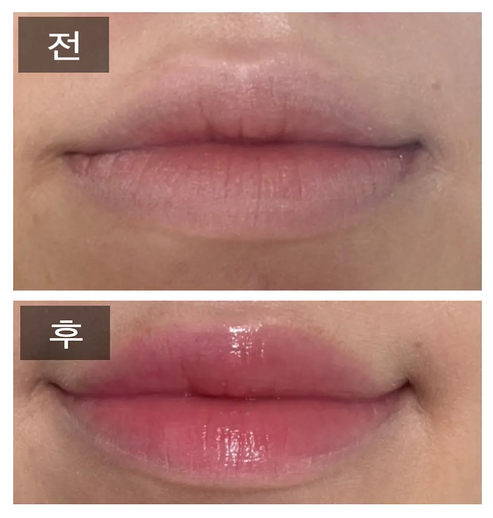 Main product photo of Durgent Lip Mask