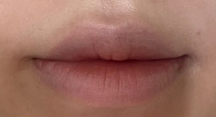 Lips with no lip product applied