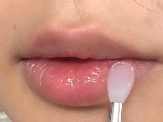 Lips with a thick layer of lip mask applied
