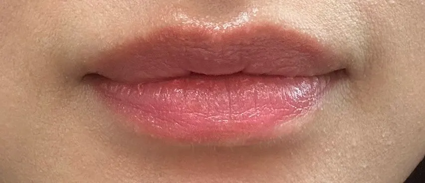 Comparison of lip texture before and after using the lip mask
