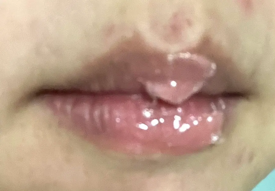 Lip mask applied on lips
