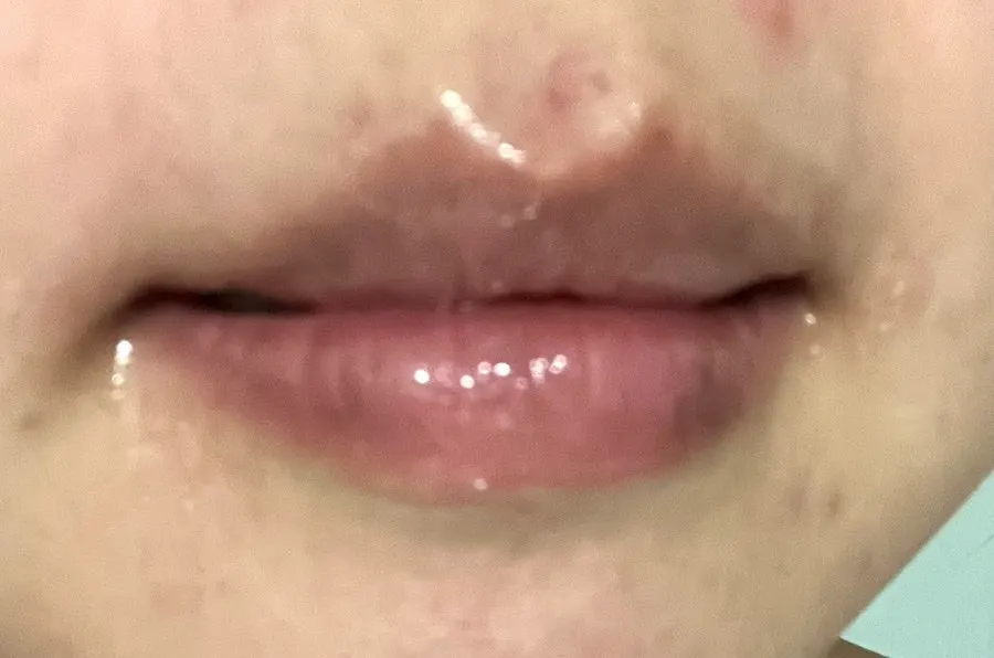 Lips after using the lip mask