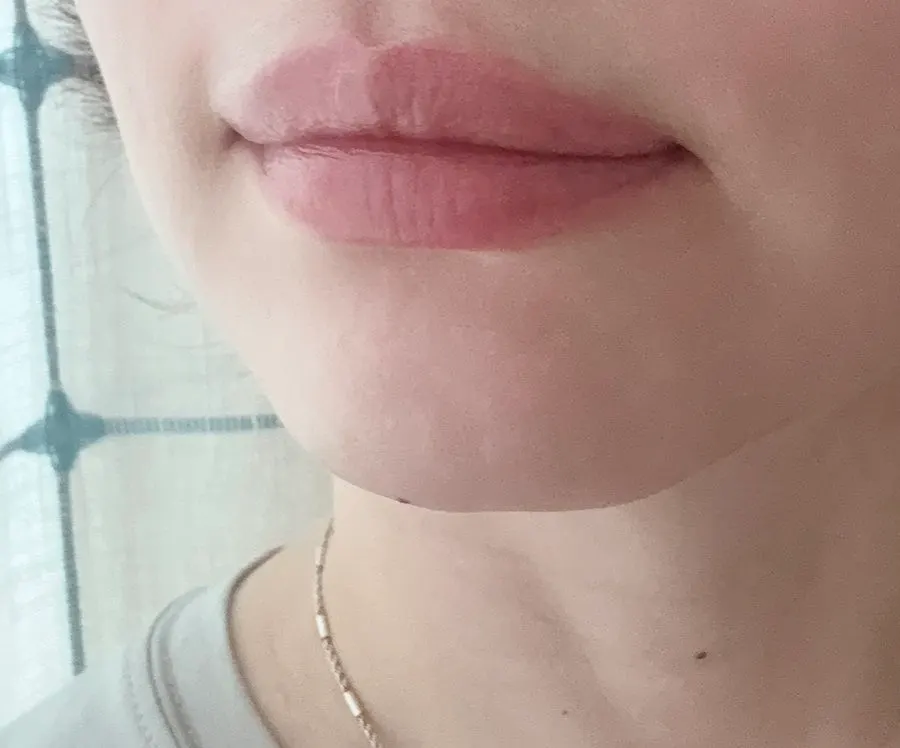 Using the Durgent Overnight Lip Mask