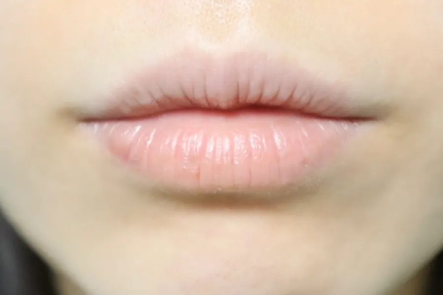 Dry lips before using the lip mask