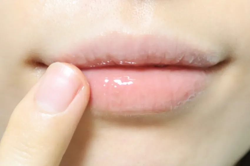 Lip mask applied over the entire lips
