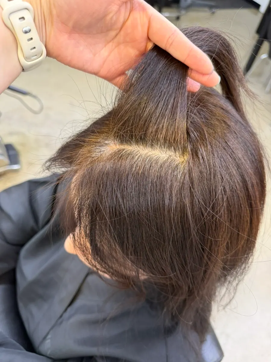 Rambut panjang pada peringkat akhir klinik
