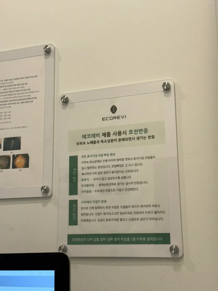 홈케어 방법 설명을 듣는 두피 상담 장면