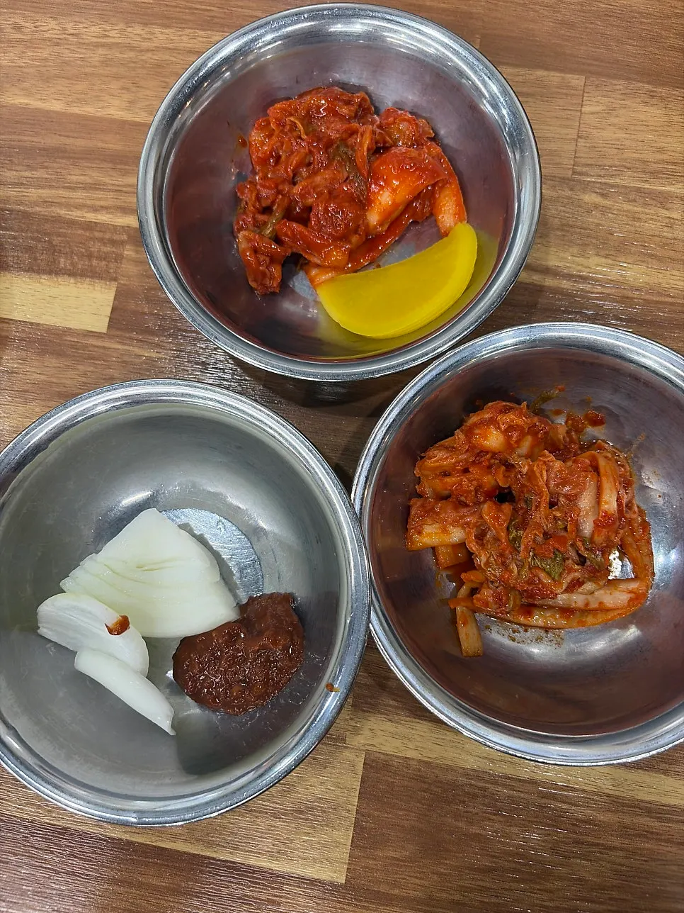 Self-serve bar with onion, ssamjang, and pickled radish