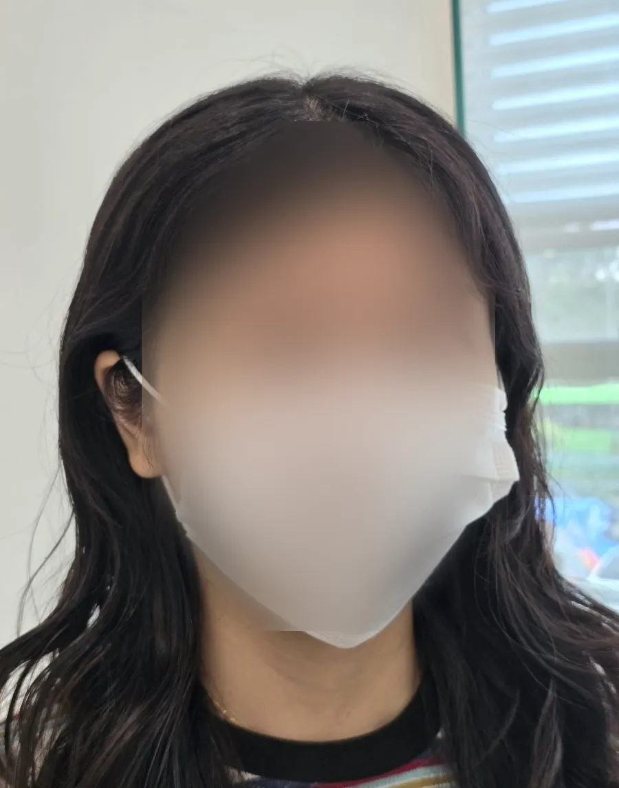 Eyes after a lash lift before an overseas trip