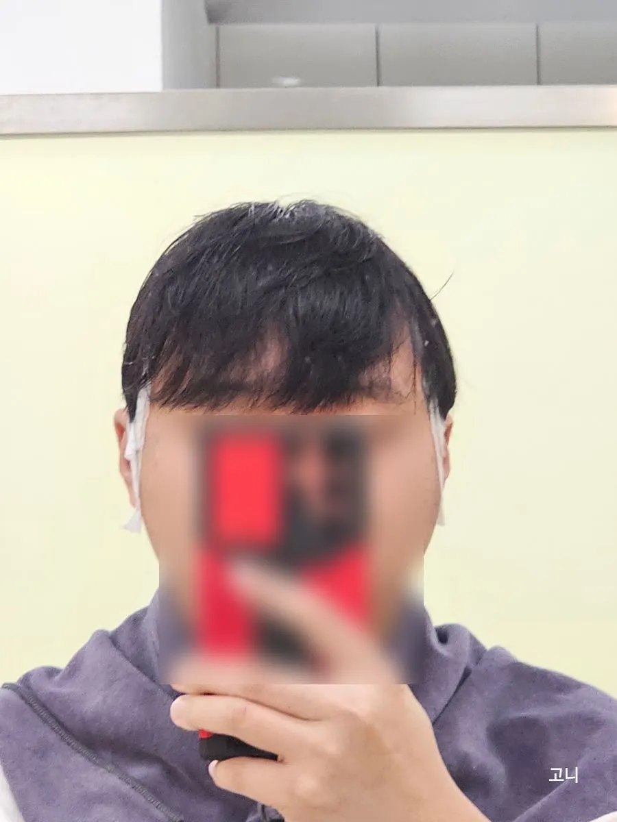 Silhouette change when the side hair is pressed down