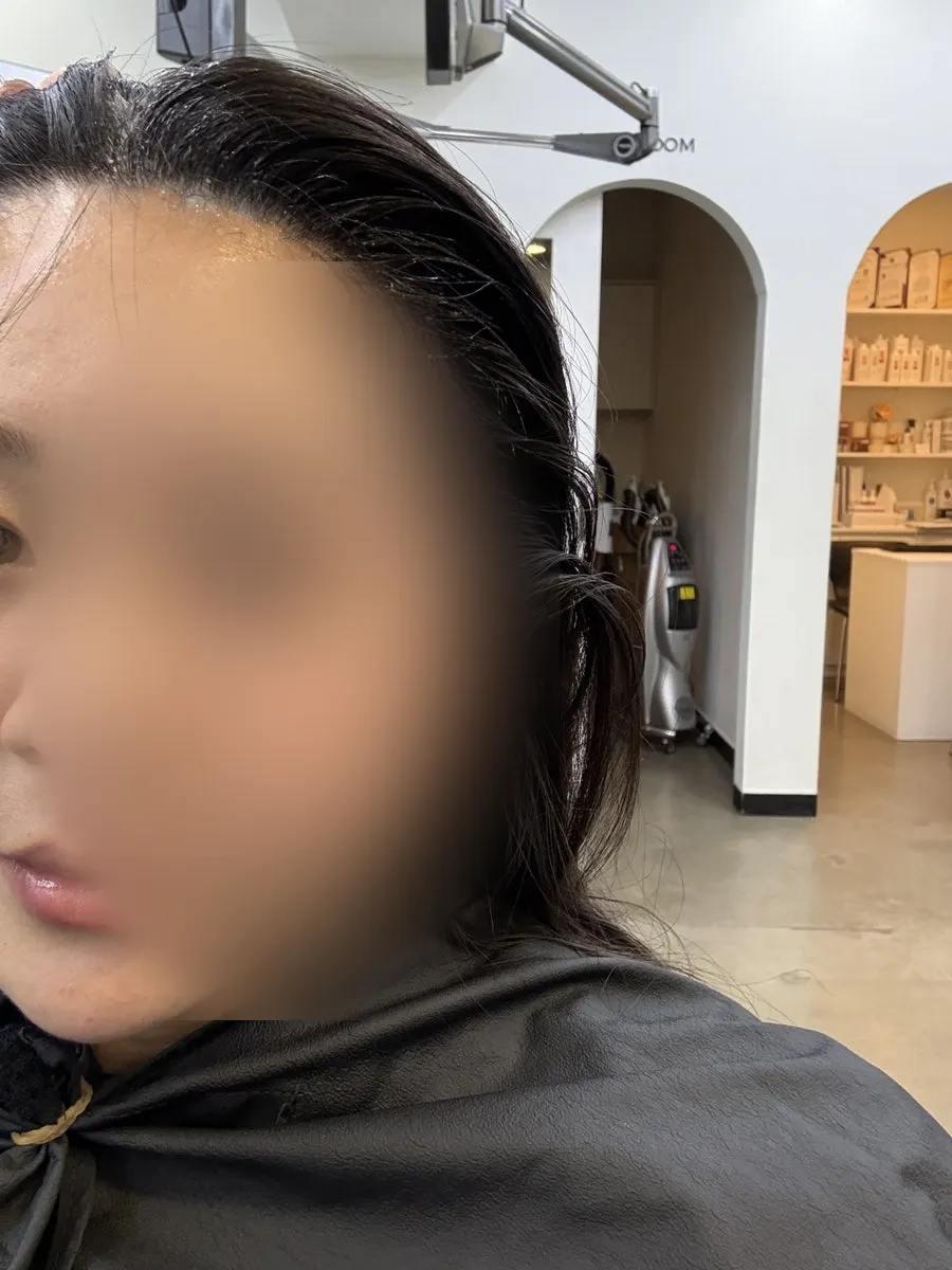 Waiting while the scalp softens