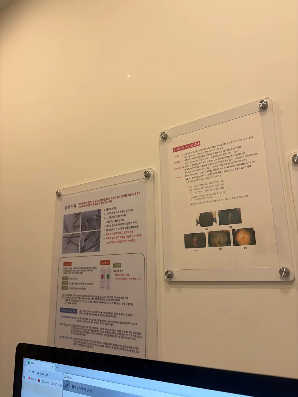 Notice on the salon wall explaining the scalp care process