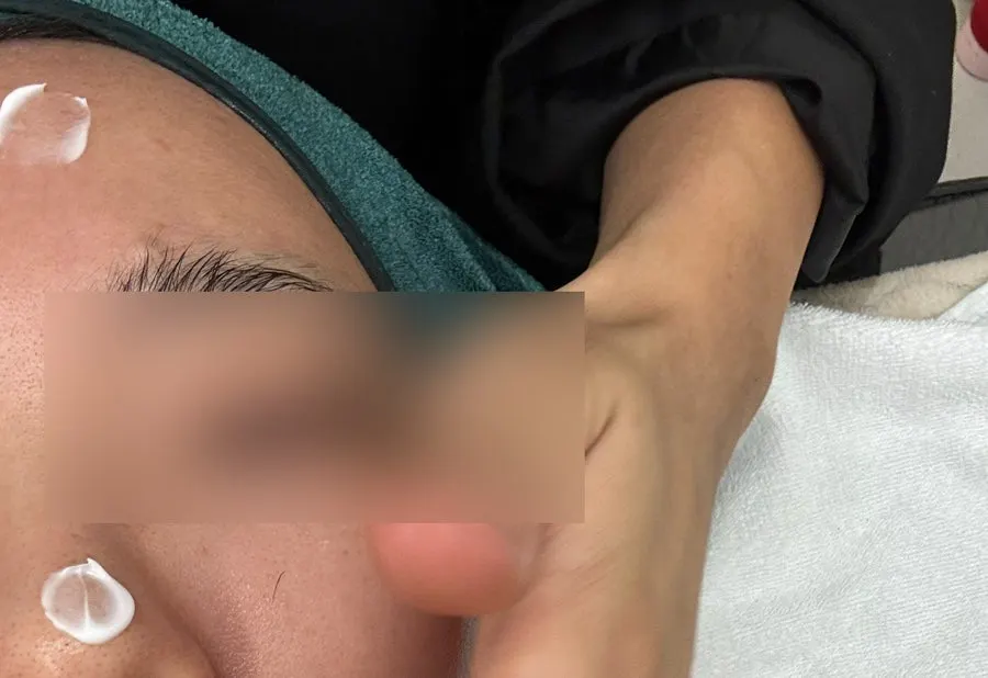 顔にパックを貼って受ける機械管理