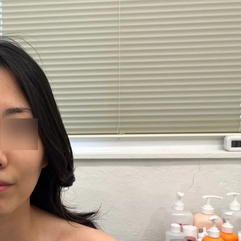 スキンケアとクリームで仕上げた管理直後の肌