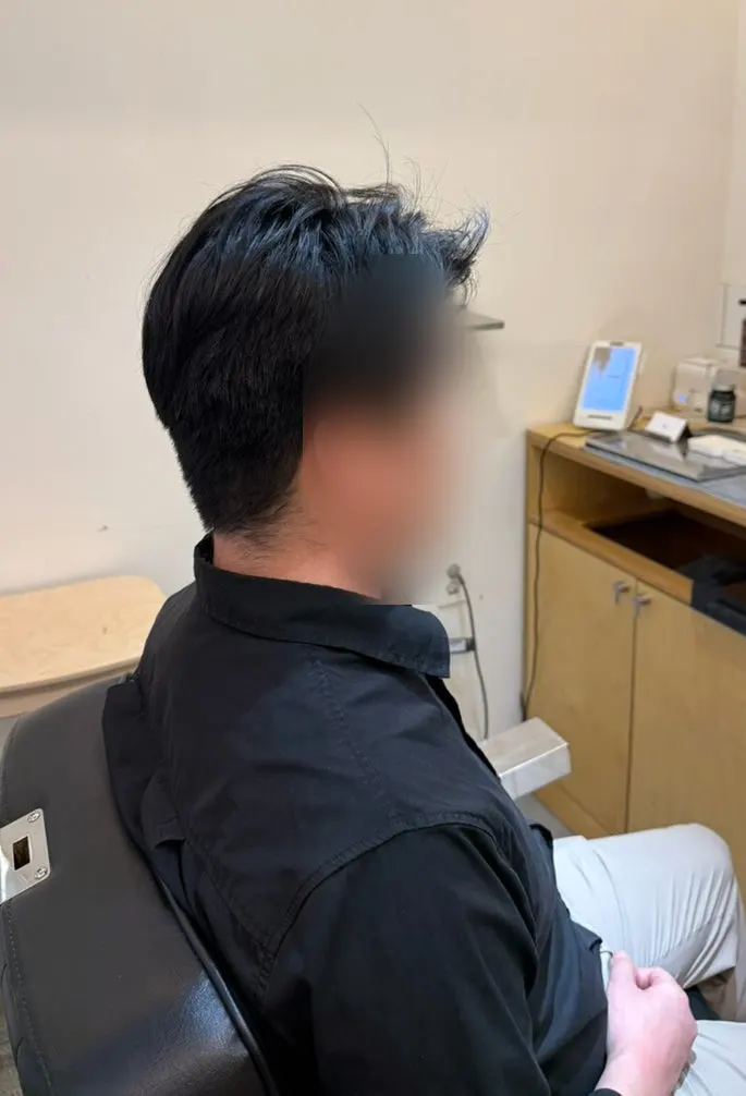 옆머리가 뜨는 비포 측면 모습