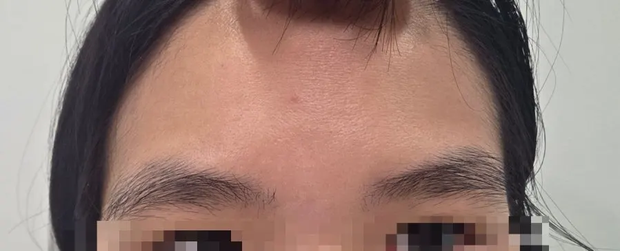 정리 전 양쪽 눈썹 비교 모습