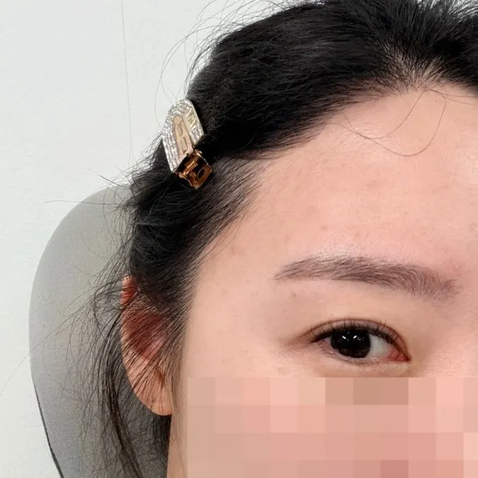 Close-up of one eyebrow groomed while the other is not yet