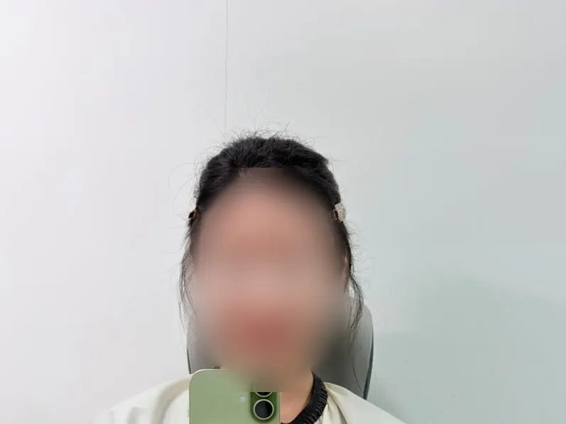 Clearer, more defined eyebrow line after grooming both sides
