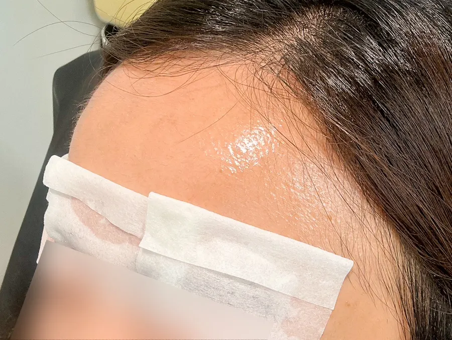 Soothing mask after eyebrow waxing
