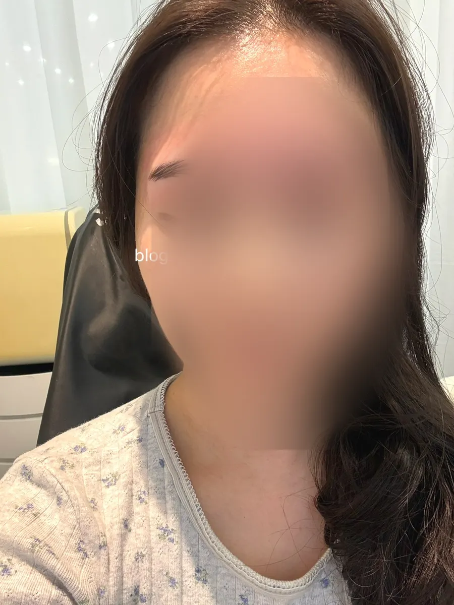 Brow line looking more defined after removing stray hairs