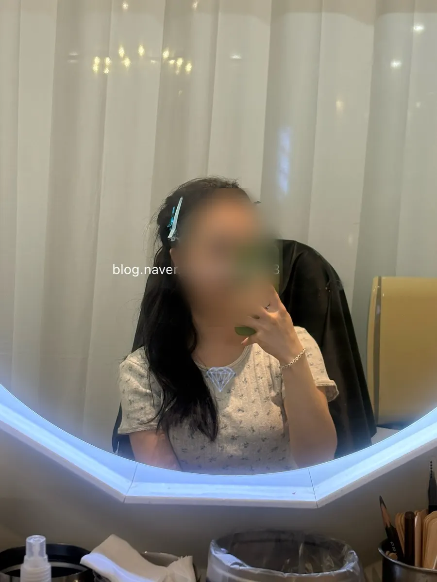 First-time brow lift procedure in progress