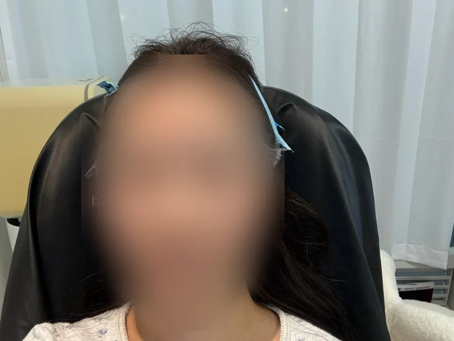 Eyebrows with texture set neatly by the brow lift