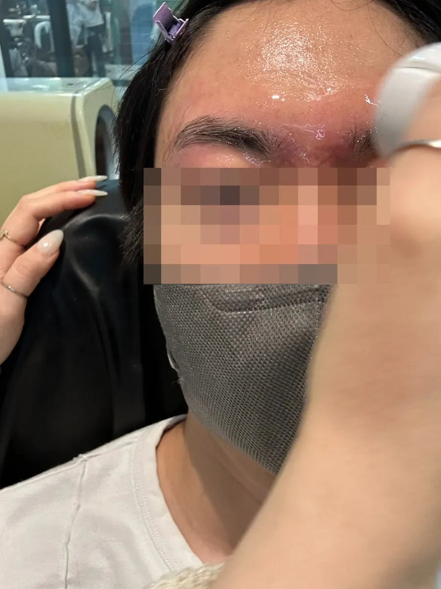 Applying warm wax along the eyebrow line